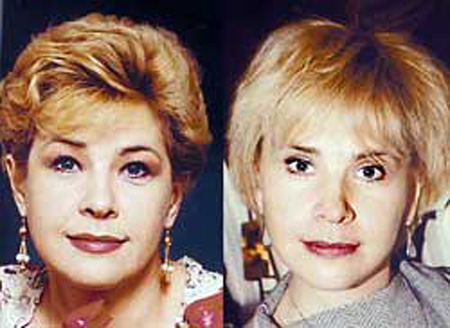 Женский алкоголизм симптомы и признаки